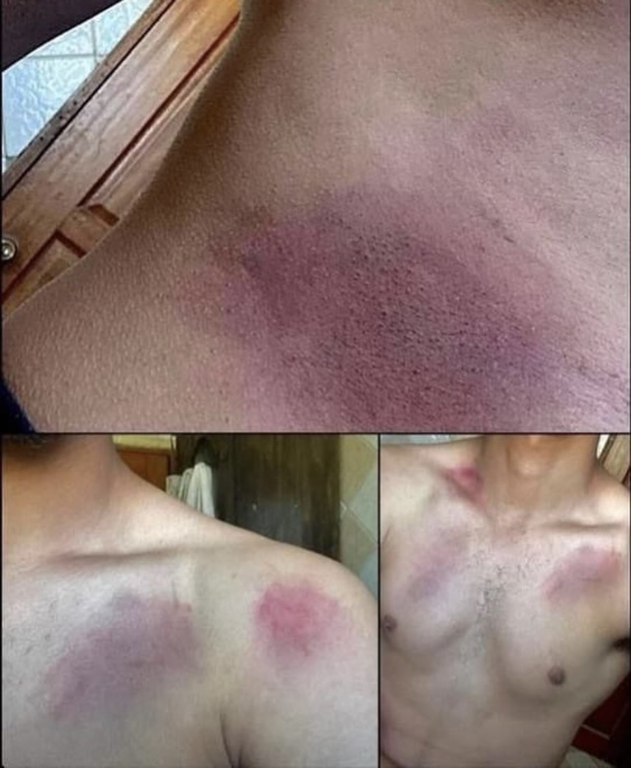 Palestinian Prisoner Shows Torture Marks After Detention
