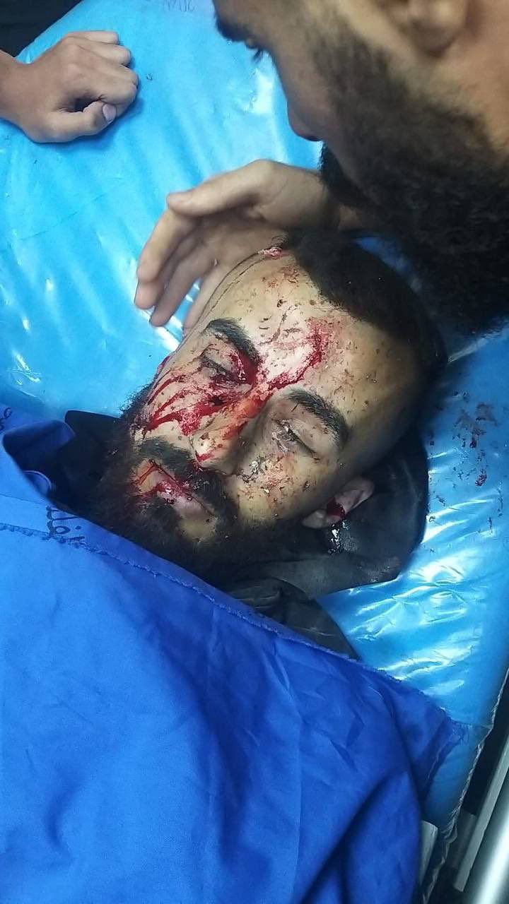 Israeli forces kill 39 Palestinians, injure 145 in West Bank