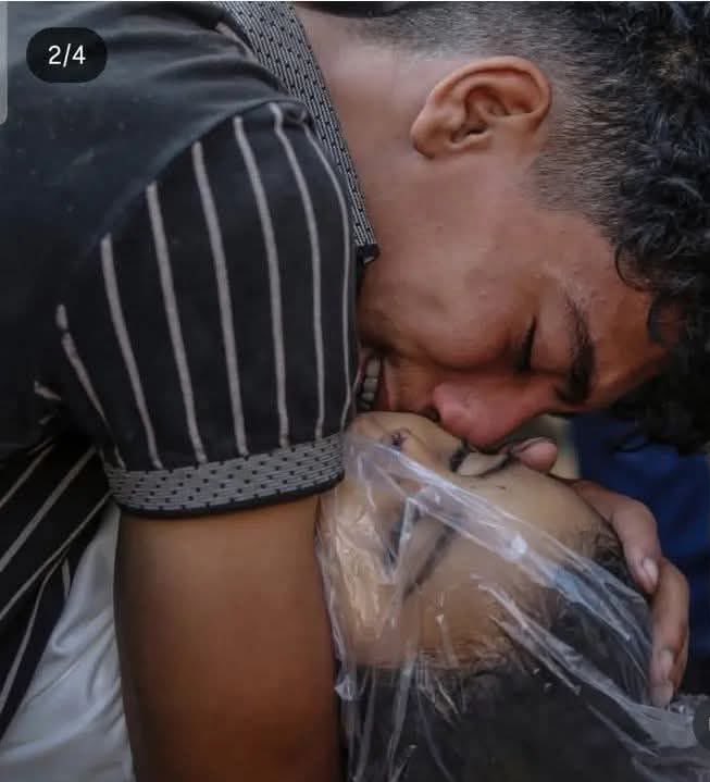 Gaza Health Crisis: Medicine Shortage and Child Trauma from Israeli Operations