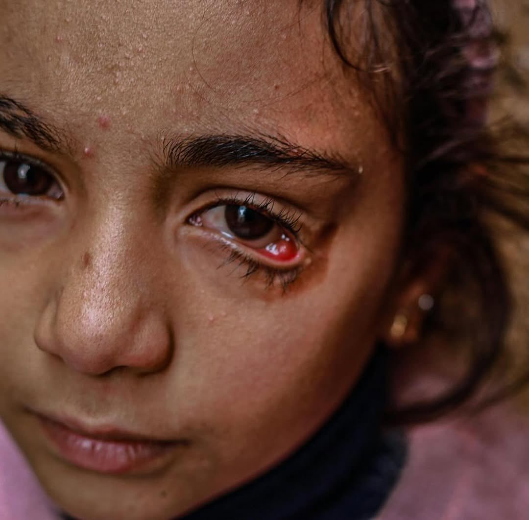 Gaza bombing survivor speaks on family loss
