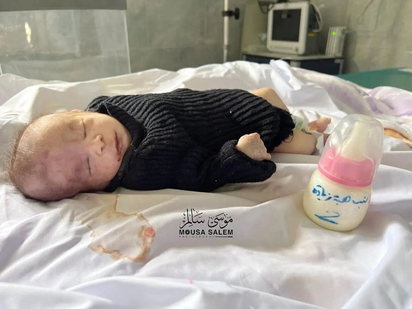 Baby Girl Heba Ziadeh Dies from Dehydration and Malnutrition