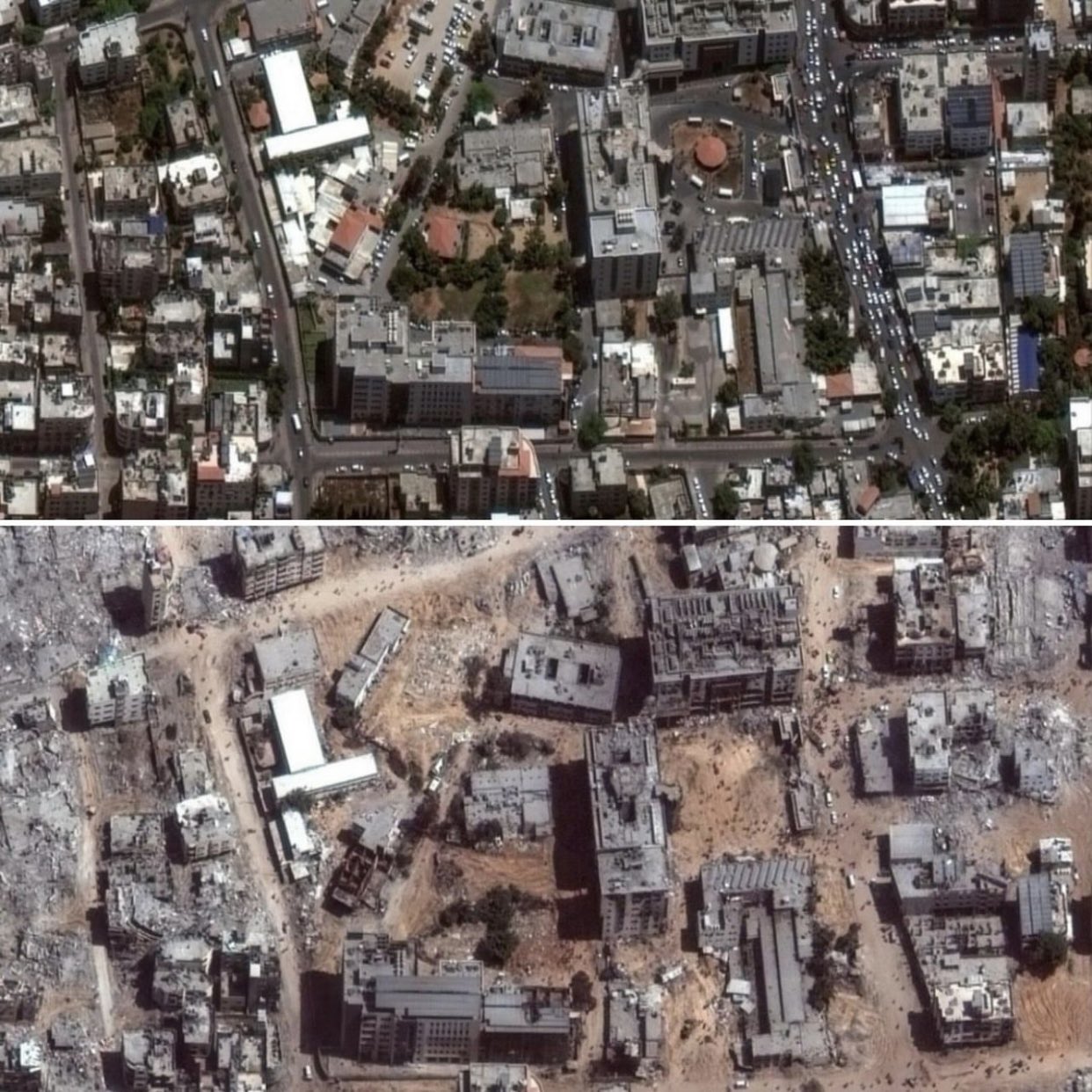 Before and after Shefa hospital destroyed by occupation forces in Gaza