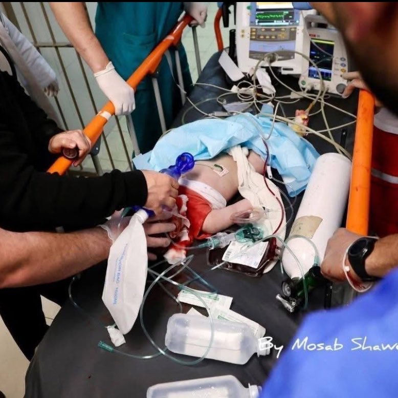 7-month-old feeding infant killed by bullets in Hebron