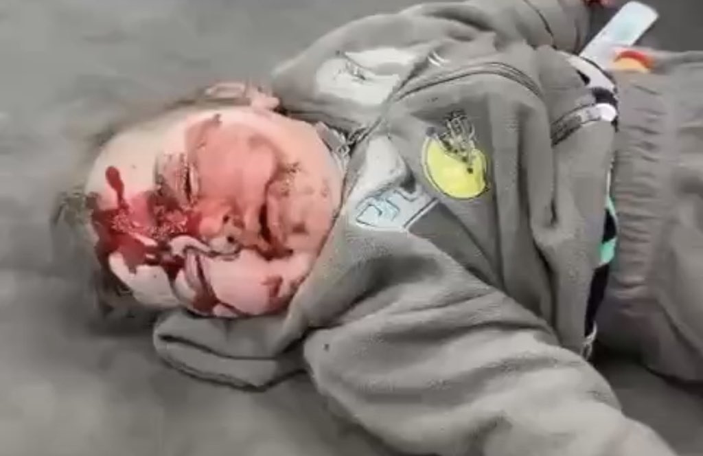 UN: 21,289 killed by Israel, no soldier tried?