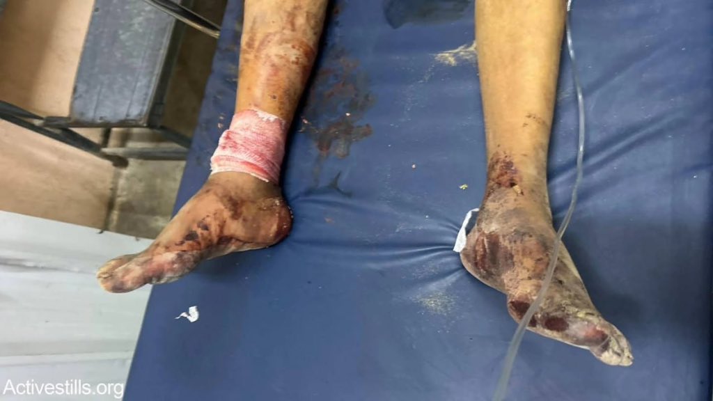 An elderly man kidnapped and tortured by Israeli forces in Gaza