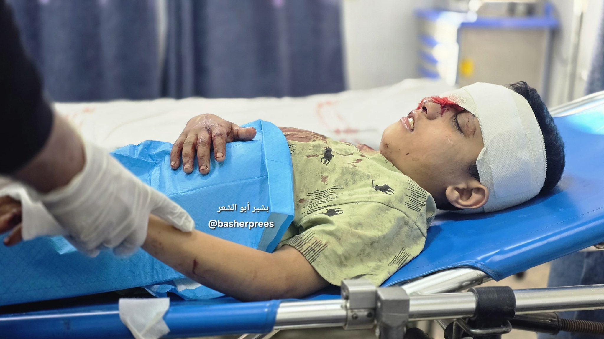 Palestinian child injured by Israeli quadcopter drone in Gaza