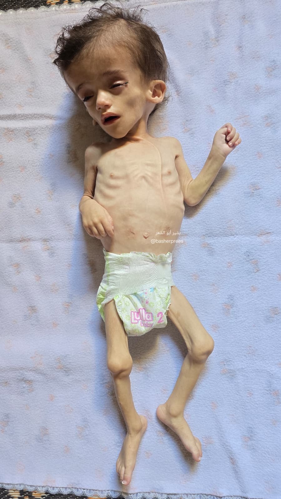 Gaza infant Issam Al-Nabih denied medical travel for over a year