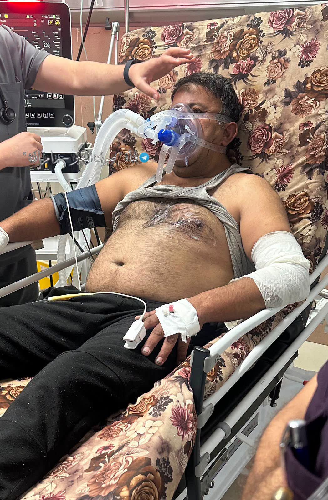 Palestinian injured in Israeli settler attack in Al-Mughayir