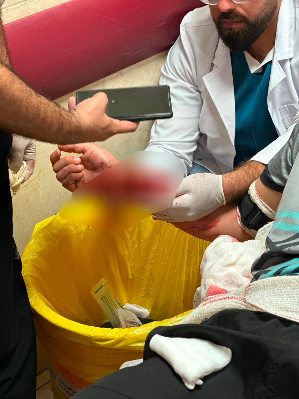 Palestinian man injured in settler assault near Burqa, Nablus