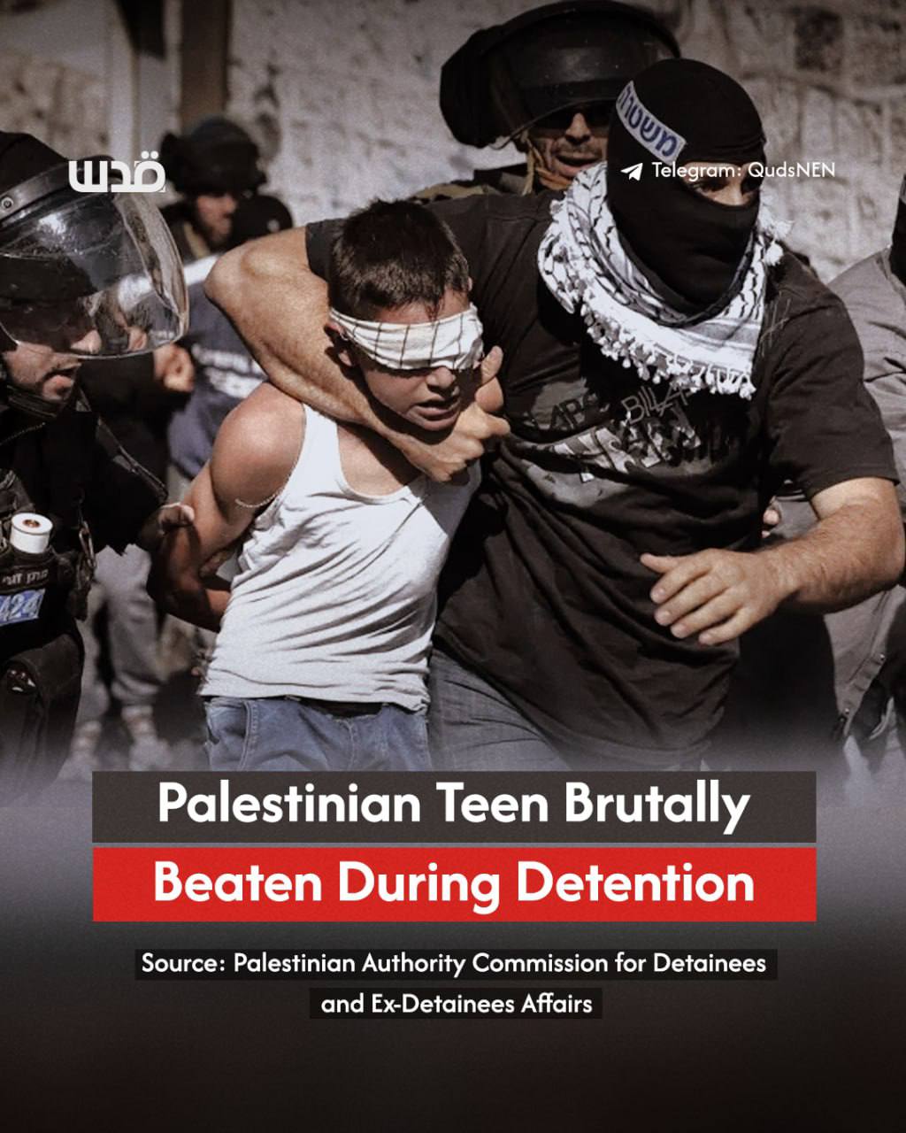 Palestinian teen detainee Adam Abu Zant beaten in Israeli custody