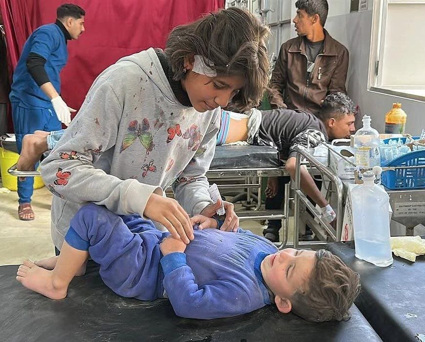 Children injured by Israeli shelling in Nuseirat camp, Gaza