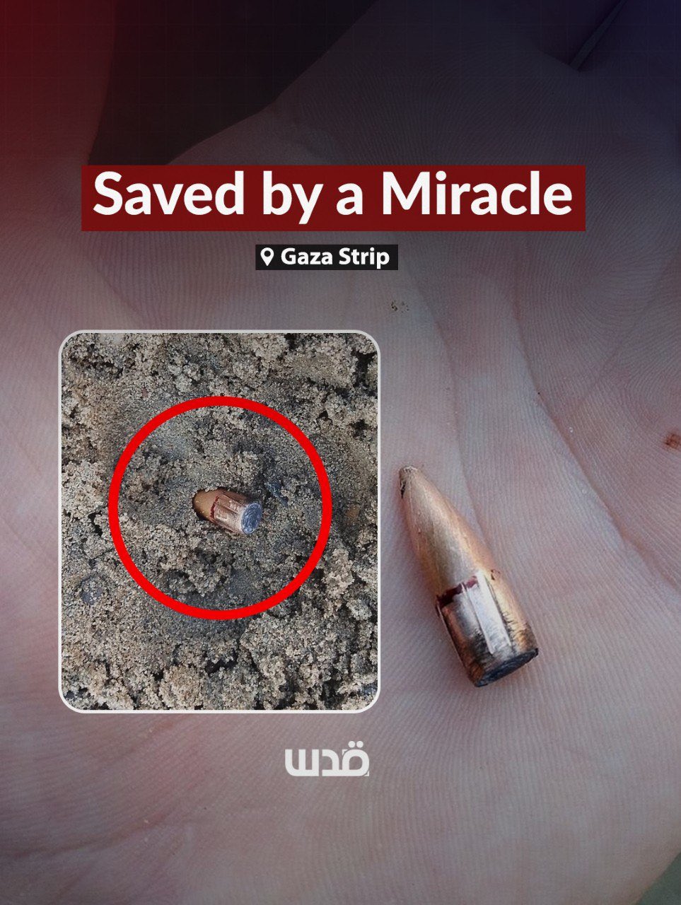 Palestinian man survives Israeli bullet in Gaza Strip