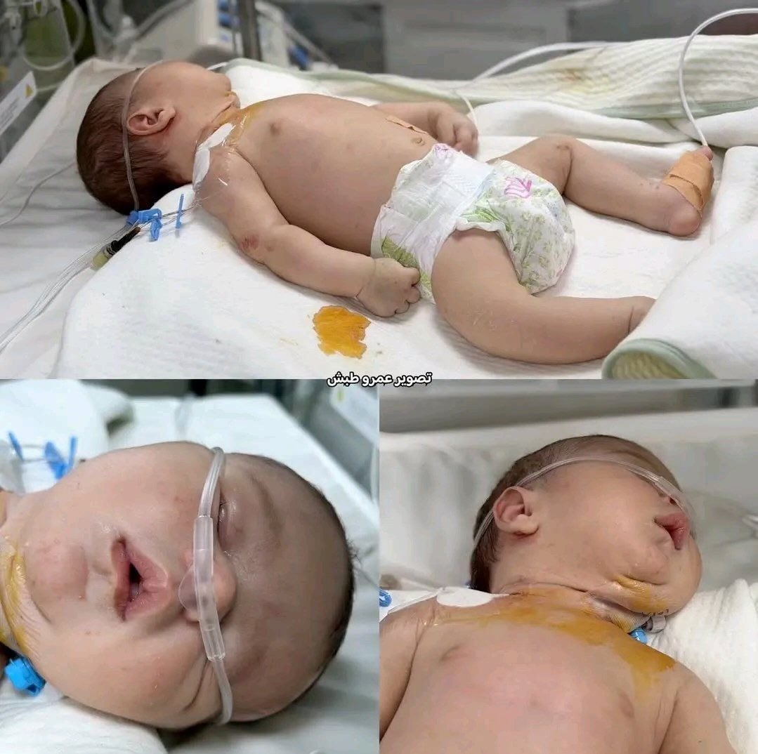 Baby Balsam Hassoum Issa dies after Israel blocked medical travel