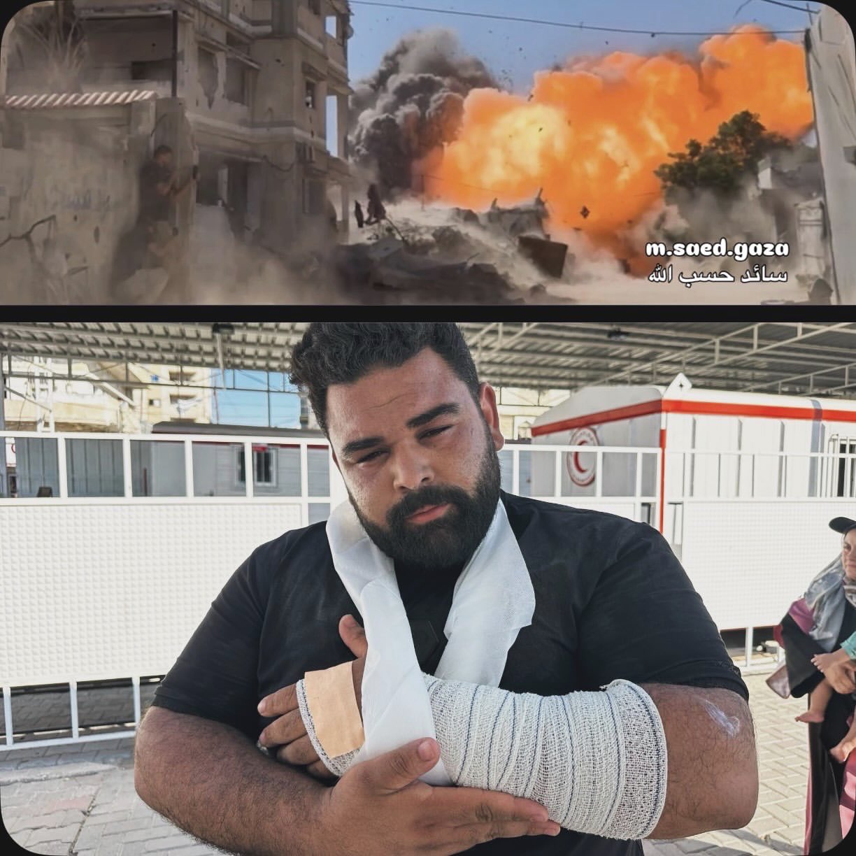 Palestinian journalist Saed Hasaballah wounded by Israeli airstrikes in Gaza City