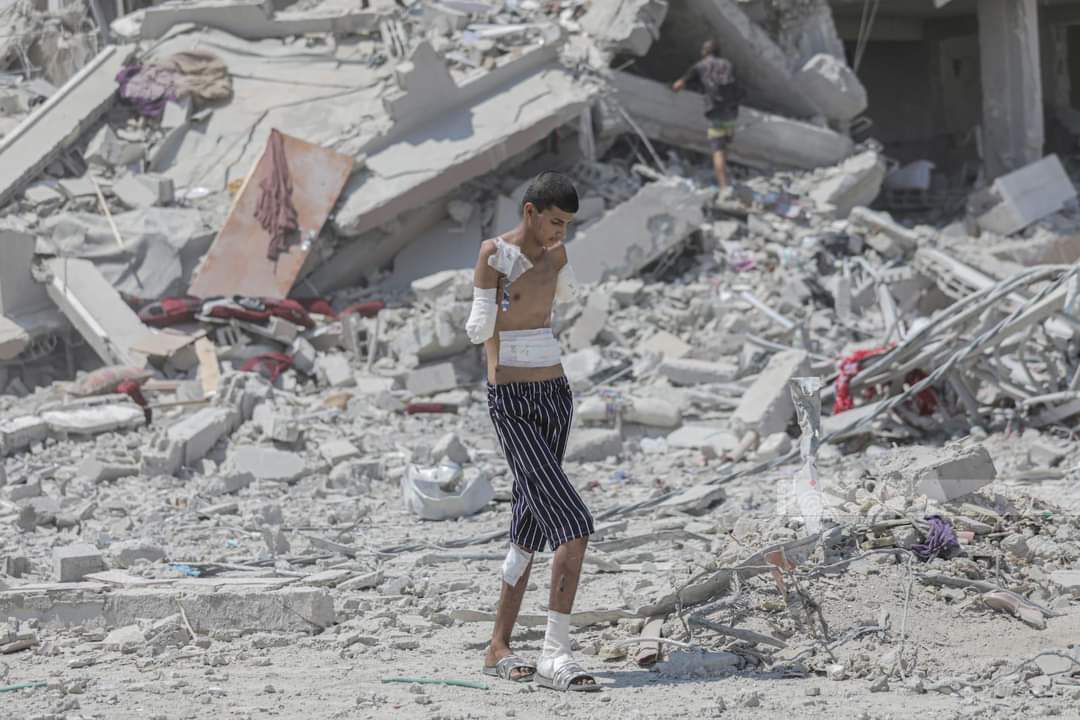 Diaa Al-Adeni loses arms in Israeli airstrike on Deir al-Balah