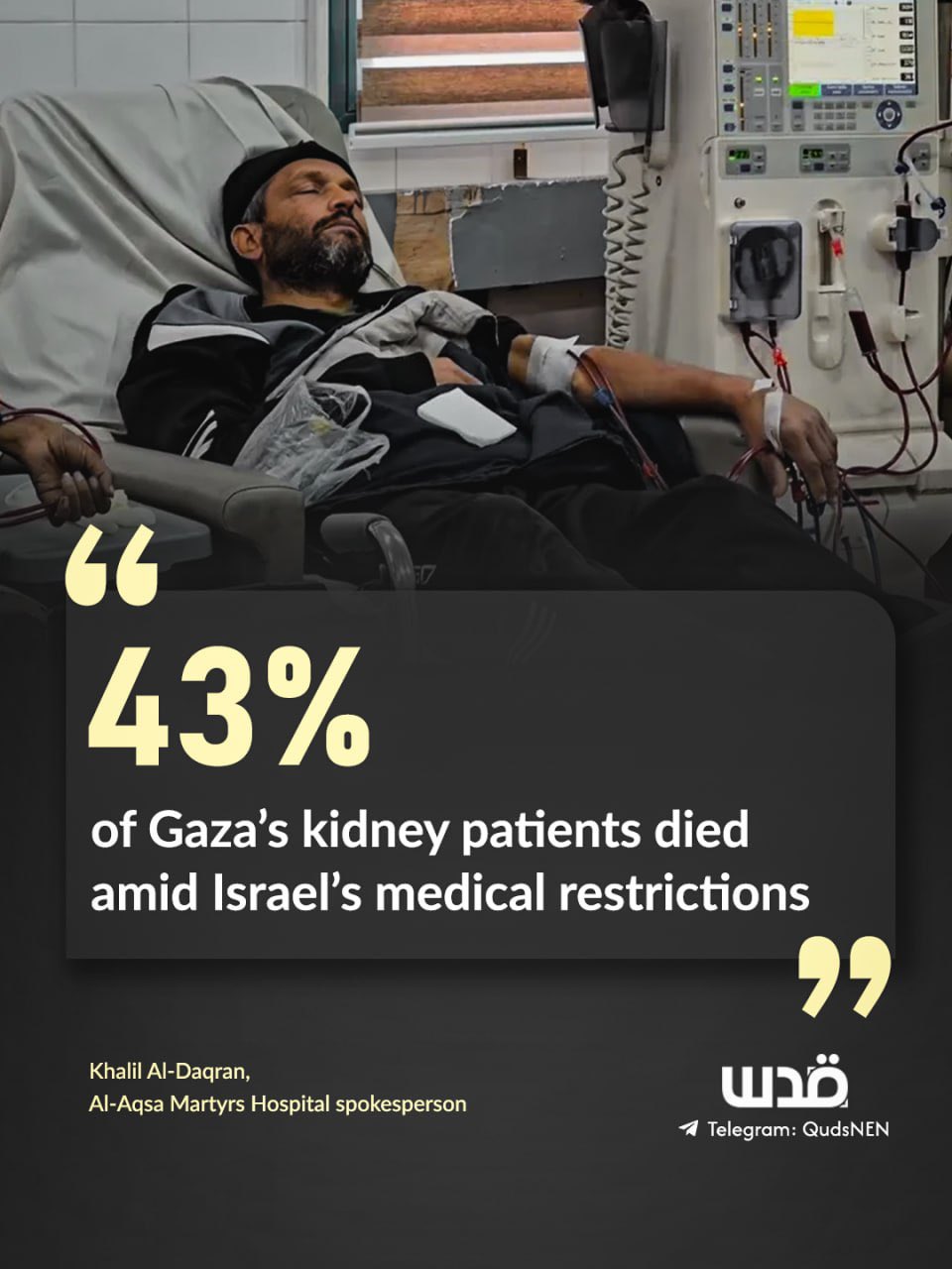 43% of Gaza kidney failure patients died since genocide began