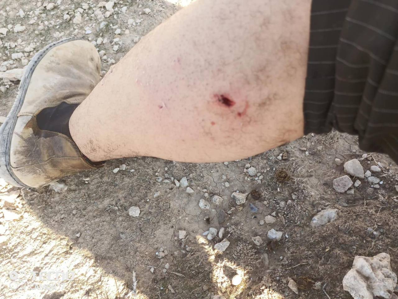 Palestinian injured by settler dog attack in Bethlehem