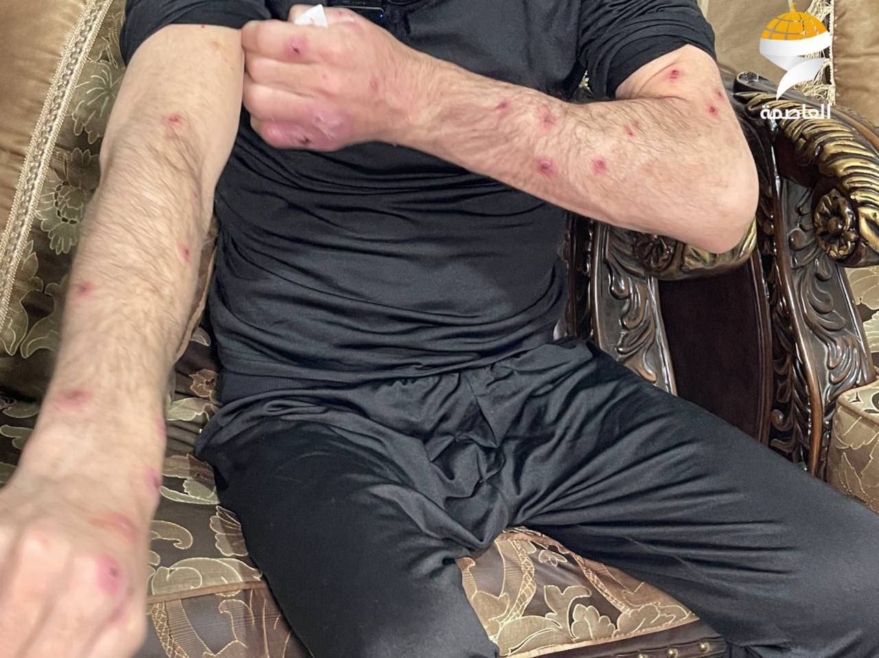 Palestinian detainee Iyad Bzeih in critical health after Israeli prison torture