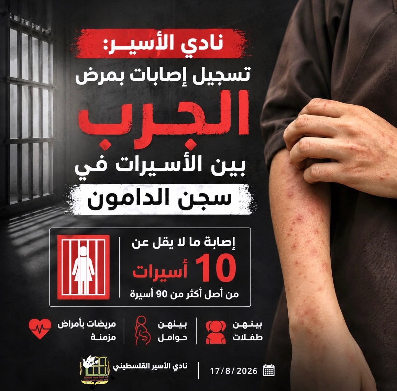 Scabies infections reported among female prisoners at Damon Prison