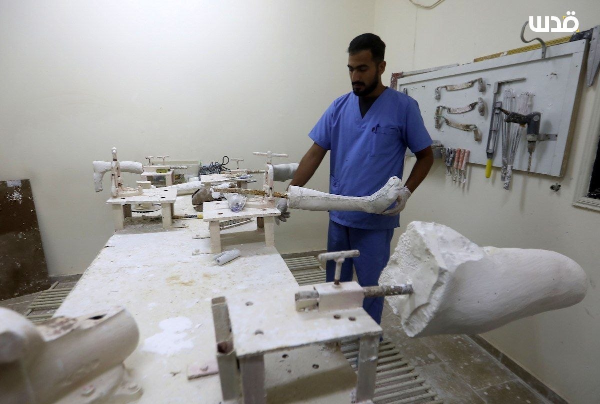 Gaza Municipality center fits prosthetic limbs for war amputees