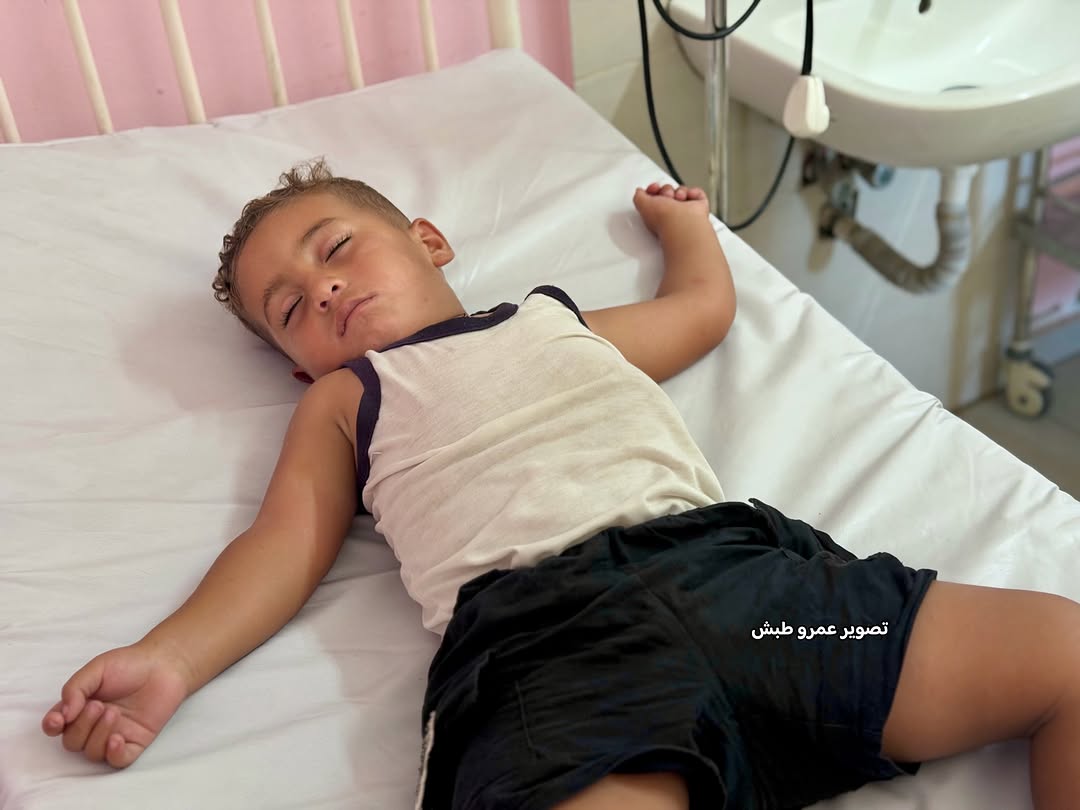 Two-year-old Bilal Al-Raqab suffers acute glomerulonephritis in Gaza