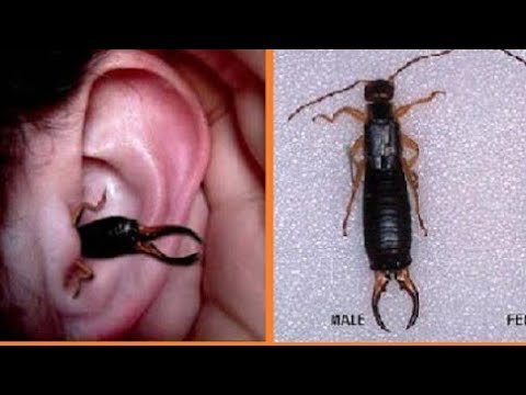 Earwig infestations spread in Gaza displacement tents amid worsening sanitation