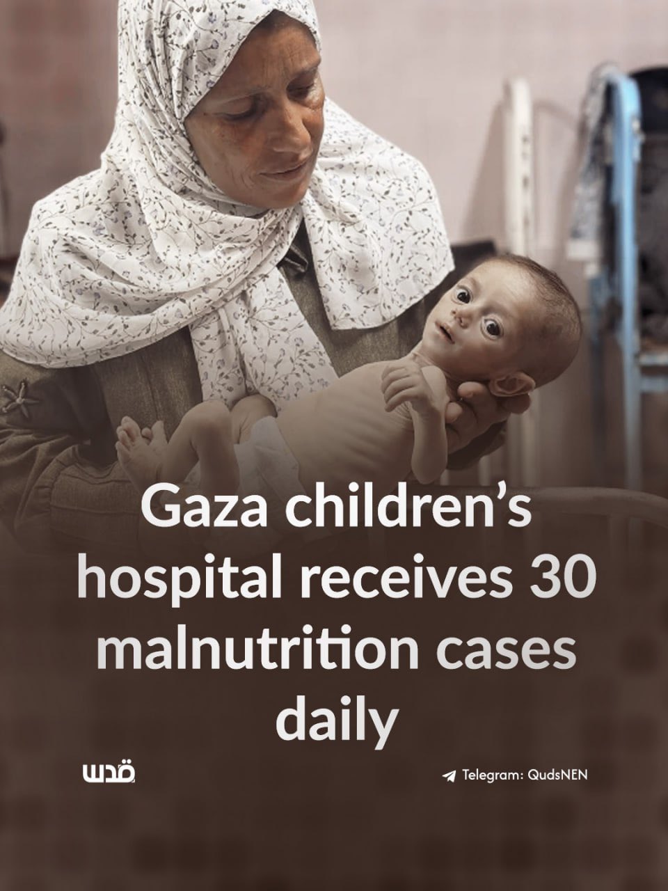 Rantisi Hospital in Gaza receives 30 malnutrition cases daily