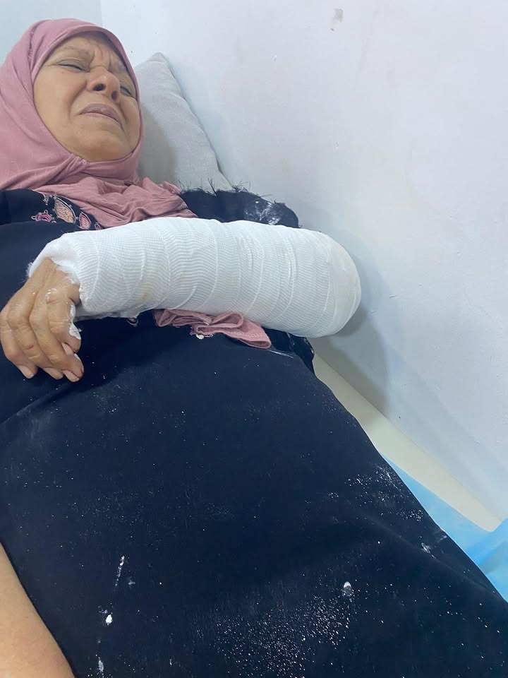 Israeli settlers assault Palestinian farmer and wife in Beitillu