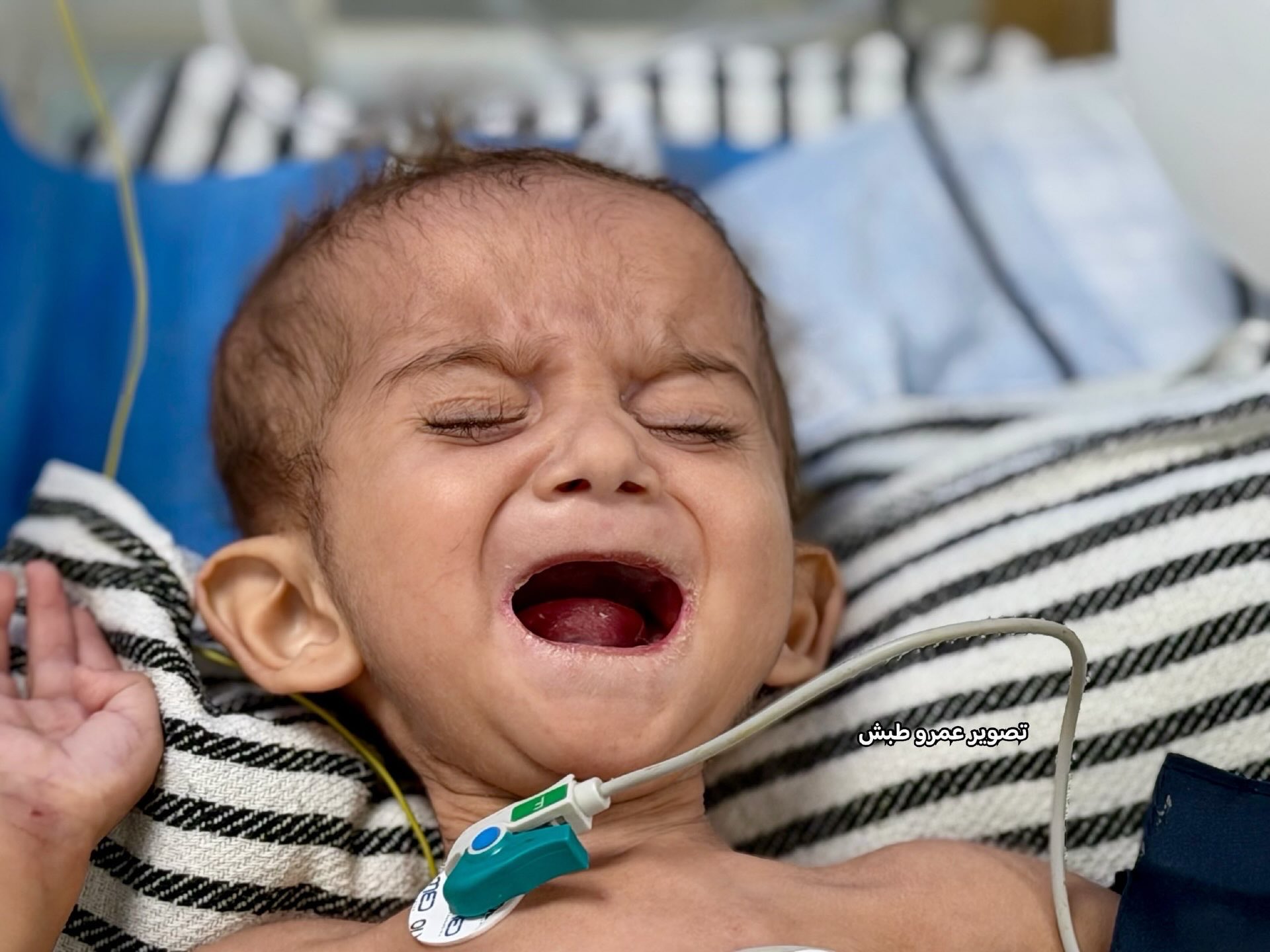 9-month-old Gaza infant Mohammed fights for life amid medical crisis