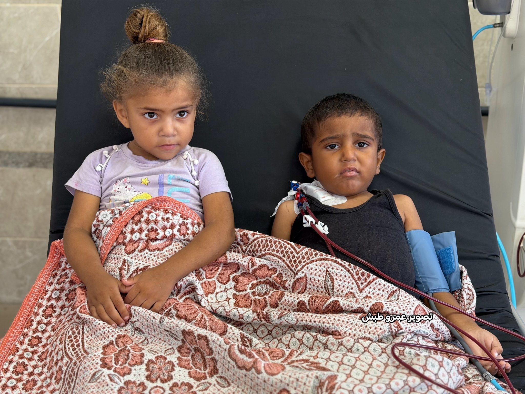 Five-year-old Gaza child with kidney failure undergoes dialysis
