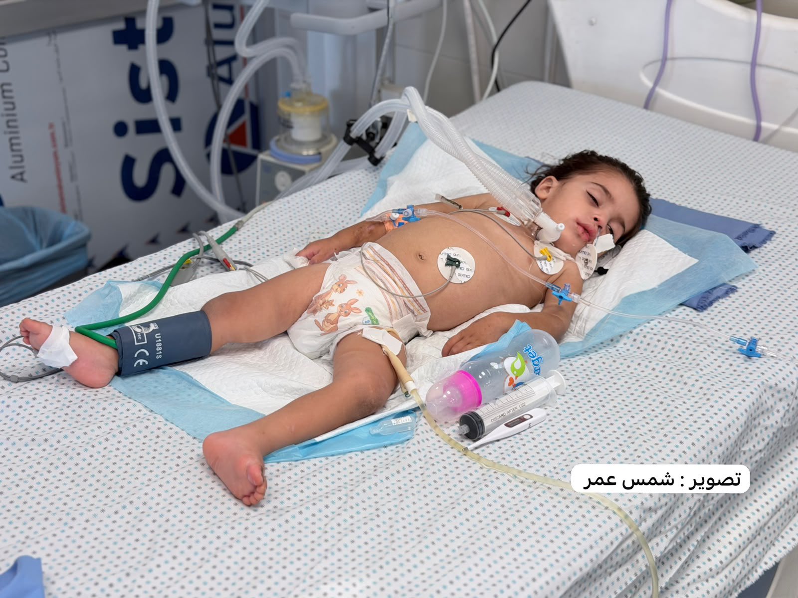 Gaza baby Waleed al Ghoola wounded, in ICU without treatment
