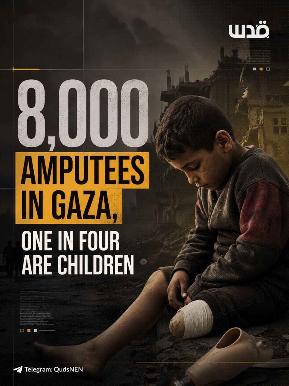 Gaza amputees rise to 8,000 amid prosthetic material shortages