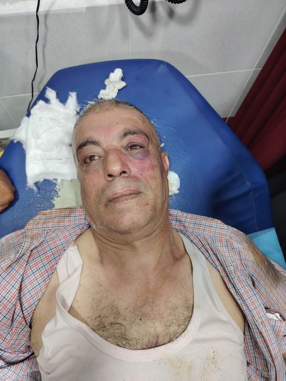 Palestinian council member assaulted by Israeli settlers near Nablus