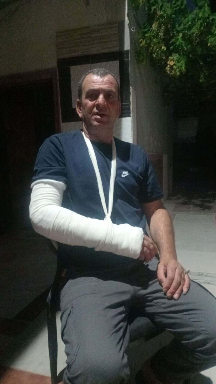 Israeli settlers attack and injure Palestinian in south Nablus