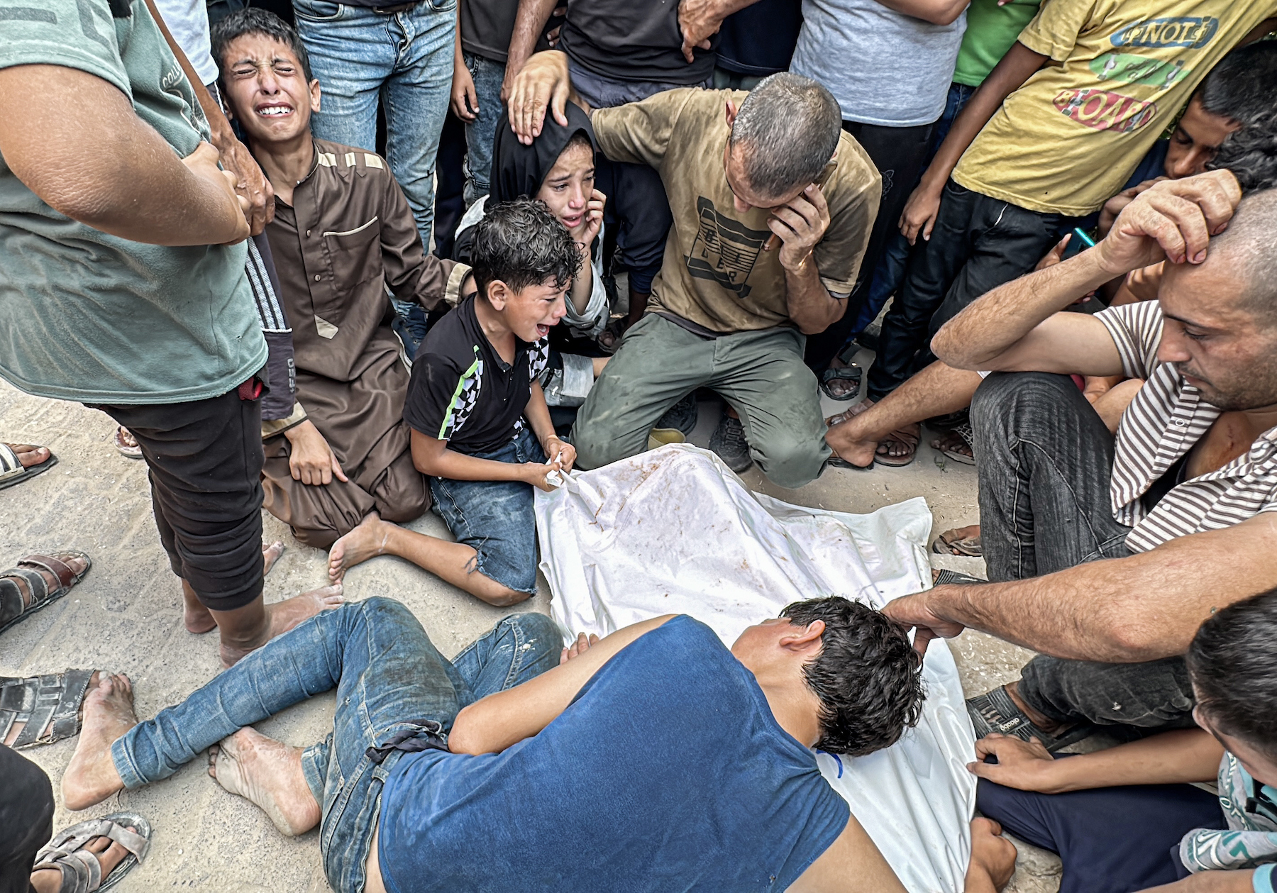 Boy injured with skull fragments at Tabaeen massacre scene