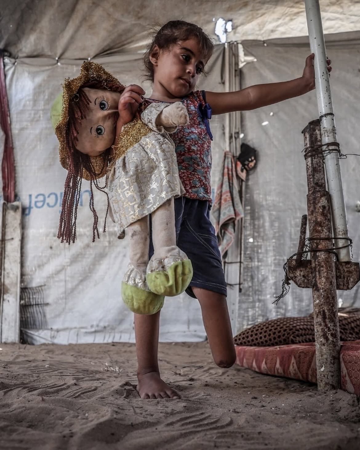 Three-year-old Jamalat Alaa Daban lost leg in Gaza attack