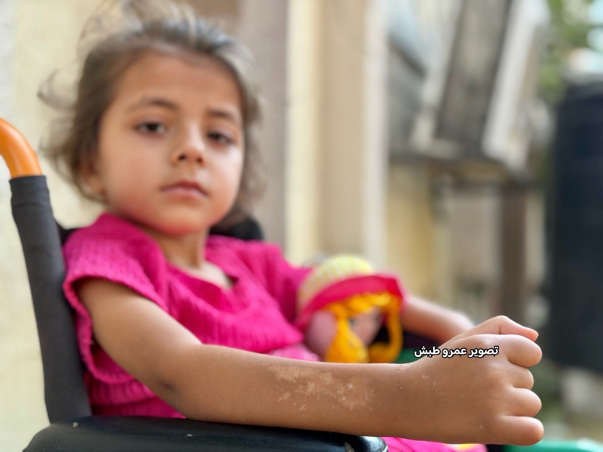 5-year-old Reem in Gaza quadriplegic from shrapnel injury